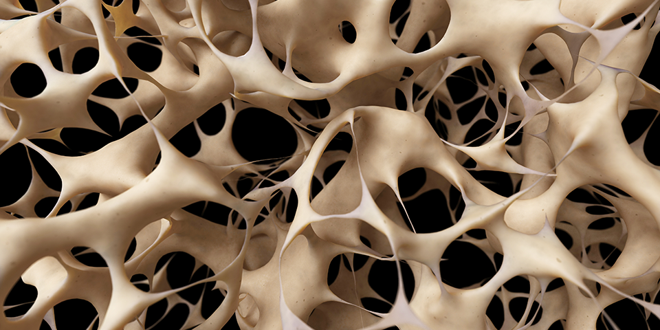 Osteoporosis can be erased with physical therapy - Hampton PT Osteoporosis can be erased with physical therapy - Hampton PT